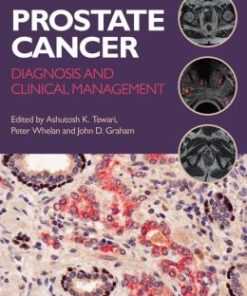 Prostate Cancer: Diagnosis and Clinical Management