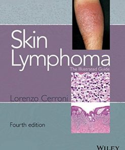 Skin Lymphoma: The Illustrated Guide