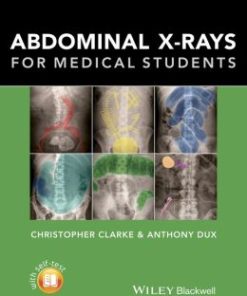 Abdominal X-rays for Medical Students