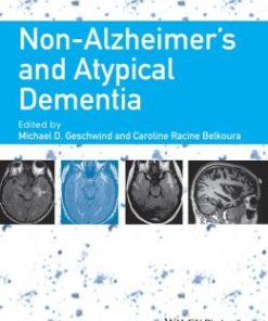 Non-Alzheimer’s and Atypical Dementia