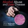 Alcohol Abuse and Liver Disease