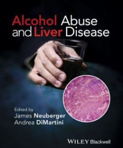 Alcohol Abuse and Liver Disease