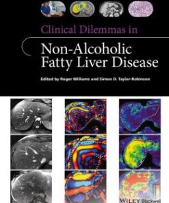 Clinical Dilemmas in Non-Alcoholic Fatty Liver Disease