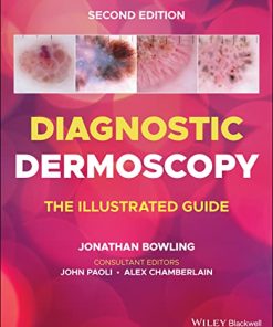 Diagnostic Dermoscopy: The Illustrated Guide, 2nd edition (PDF)