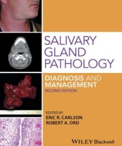 Salivary Gland Pathology: Diagnosis and Management, 2nd Edition