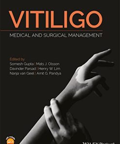 Vitiligo: Medical and Surgical Managmement (PDF)