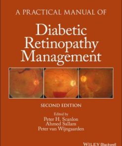 A Practical Manual of Diabetic Retinopathy Management, 2nd Edition (PDF)