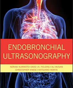 Endobronchial Ultrasonography, 2nd Edition (PDF)