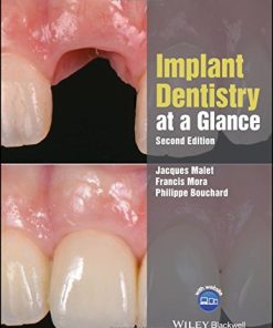 Implant Dentistry at a Glance (At a Glance (Dentistry)) (PDF)