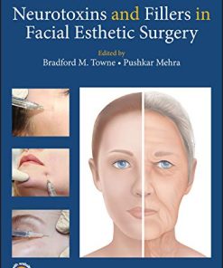 Neurotoxins and Fillers in Facial Esthetic Surgery (PDF)