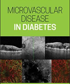 Microvascular Disease in Diabetes (PDF)