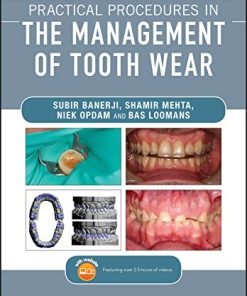 Practical Procedures in the Management of Tooth Wear (PDF)