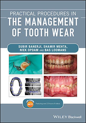 Practical Procedures in the Management of Tooth Wear (PDF) Practical Procedures in the Management of Tooth Wear (PDF)