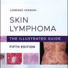 Skin Lymphoma: The Illustrated Guide, 5th Edition (PDF) Skin Lymphoma: The Illustrated Guide, 5th Edition (PDF)
