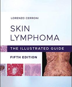 Skin Lymphoma: The Illustrated Guide, 5th Edition (PDF)