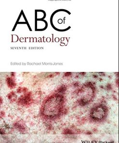 ABC of Dermatology (ABC Series) (EPUB)