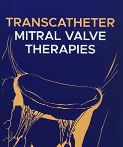 Transcatheter Mitral Valve Therapies (EPUB)