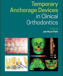 Temporary Anchorage Devices in Clinical Orthodontics (PDF)