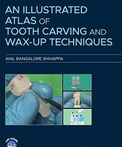 An Illustrated Atlas of Tooth Carving and Wax-Up Techniques (PDF)