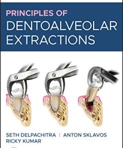 Principles of Dentoalveolar Extractions (PDF)