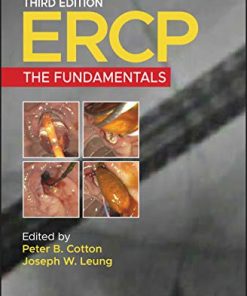 ERCP: The Fundamentals, 3rd Edition (EPUB)