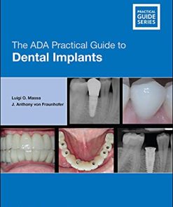 The ADA Practical Guide to Dental Implants (PDF)