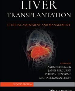 Liver Transplantation: Clinical Assessment and Management, 2nd Edition (PDF)