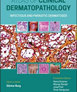 Atlas Clinical of Dermatopathology: Infectious and Parasitic Dermatoses (PDF)