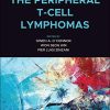 The Peripheral T-Cell Lymphomas (PDF)