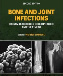 Bone and Joint Infections: From Microbiology to Diagnostics and Treatment, 2nd edition (PDF)