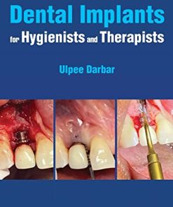 Dental Implants for Hygienists and Therapists (PDF)