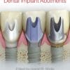 Clinical and Laboratory Manual of Dental Implant Abutments (PDF)