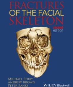 Fractures of the Facial Skeleton, 2nd Edition