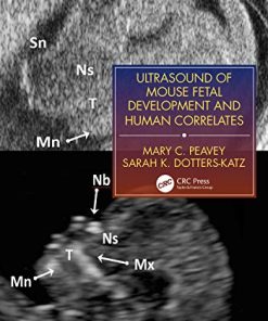 Ultrasound of Mouse Fetal Development and Human Correlates (Reproductive Medicine and Assisted Reproductive Techniques Series) (PDF)