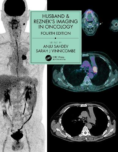 Husband & Reznek’s Imaging in Oncology, 4th edition (PDF) Husband & Reznek’s Imaging in Oncology, 4th edition (PDF)