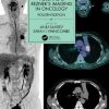 Husband & Reznek’s Imaging in Oncology, 4th edition (EPUB)