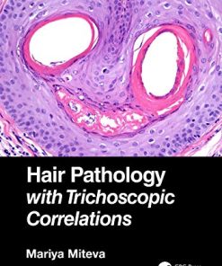 Hair Pathology with Trichoscopic Correlations (PDF)