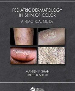 Pediatric Dermatology in Skin of Color: A Practical Guide (PDF)