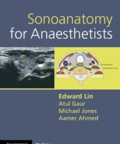 Sonoanatomy for Anaesthetists