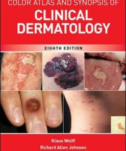 Fitzpatrick’s Color Atlas and Synopsis of Clinical Dermatology, Eighth Edition (PDF)