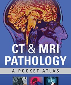 CT & MRI Pathology: A Pocket Atlas, Third Edition (EPUB)