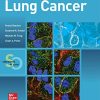 Lung Cancer: Standards of Care (EPUB)