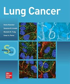 Lung Cancer: Standards of Care (High Quality PDF)