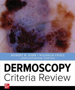 Dermoscopy Criteria Review (PDF)