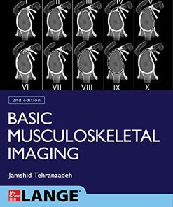 Basic Musculoskeletal Imaging, Second Edition (PDF)