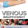 Venous Insufficiency (EPUB)