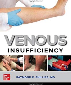 Venous Insufficiency (EPUB)