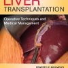 Liver Transplantation: Operative Techniques and Medical Management (PDF)