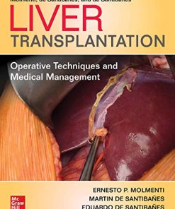 Liver Transplantation: Operative Techniques and Medical Management (High Quality PDF)