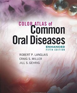 Color Atlas of Common Oral Diseases, Enhanced 5th Edition (PDF)